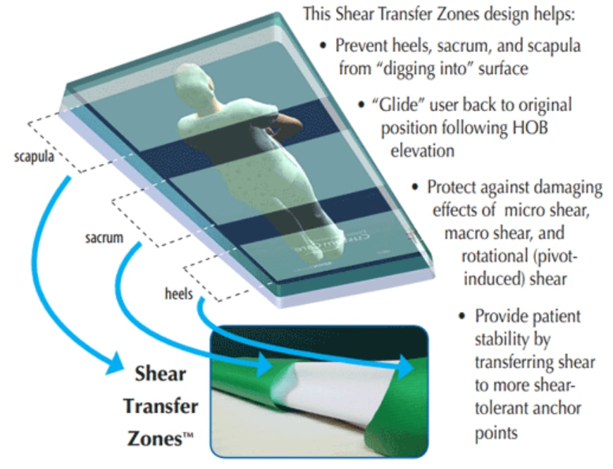 Shear Transfer Zones™ graphic showing design a placement of zones